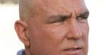 Vinnie Jones też ma raka skóry