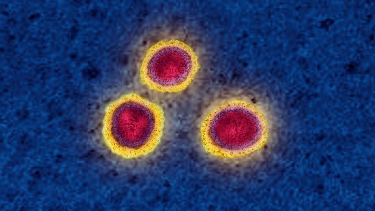 Naukowcy odkryli, że koronawirus "kamufluje się" w zainfekowanych komórkach gospodarza
