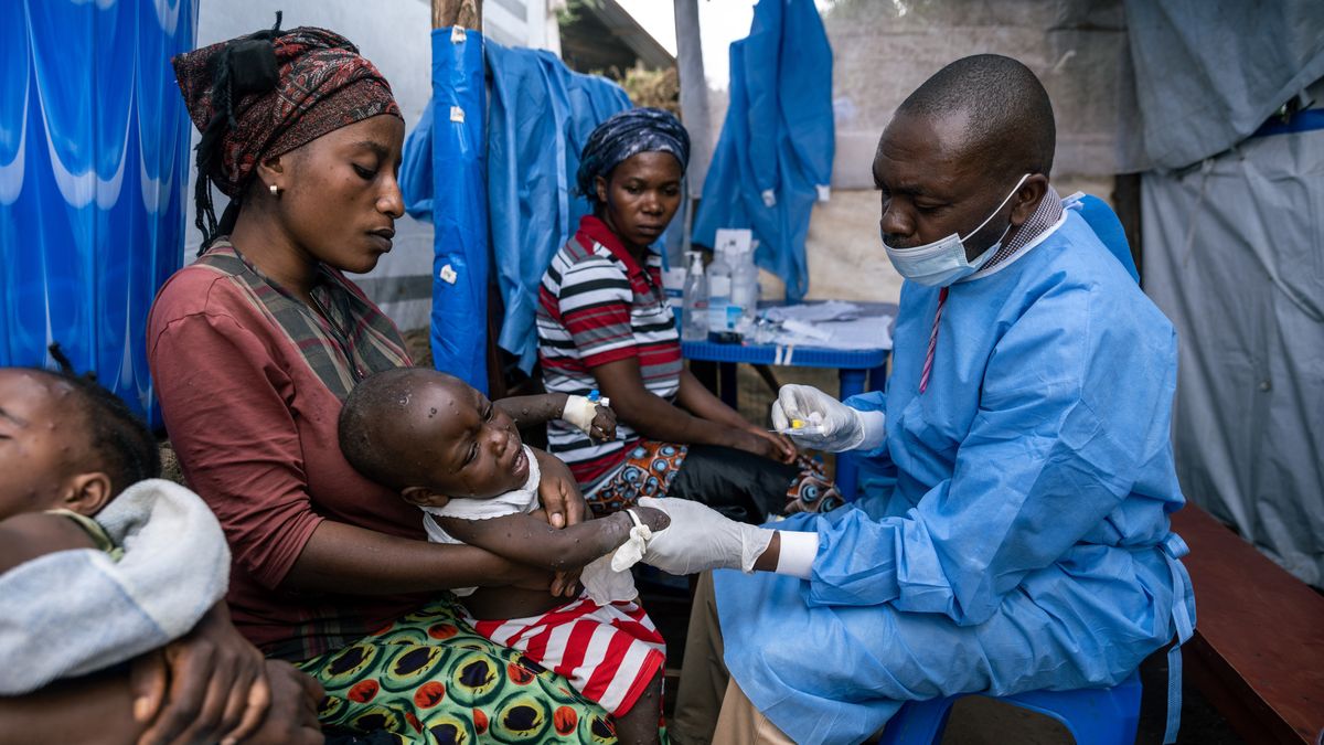 Epidemia dotknęła regionu,w którym szczepienia nie są powszechne