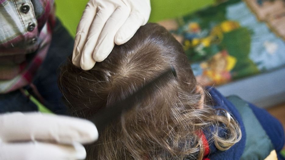 Wszawica nie jest objęta działaniem Państwowej Inspekcji Sanitarnej. Nie ma podstaw do wydania decyzji nakazującej   wstrzymanie się od uczęszczania do szkoły
