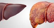 Sprawdź, jak wątroba reaguje na alkohol