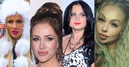 Nowy nos, usta, uszy, policzki i piersi - tak zmieniały się uczestniczki "Warsaw Shore" (ZDJĘCIA)