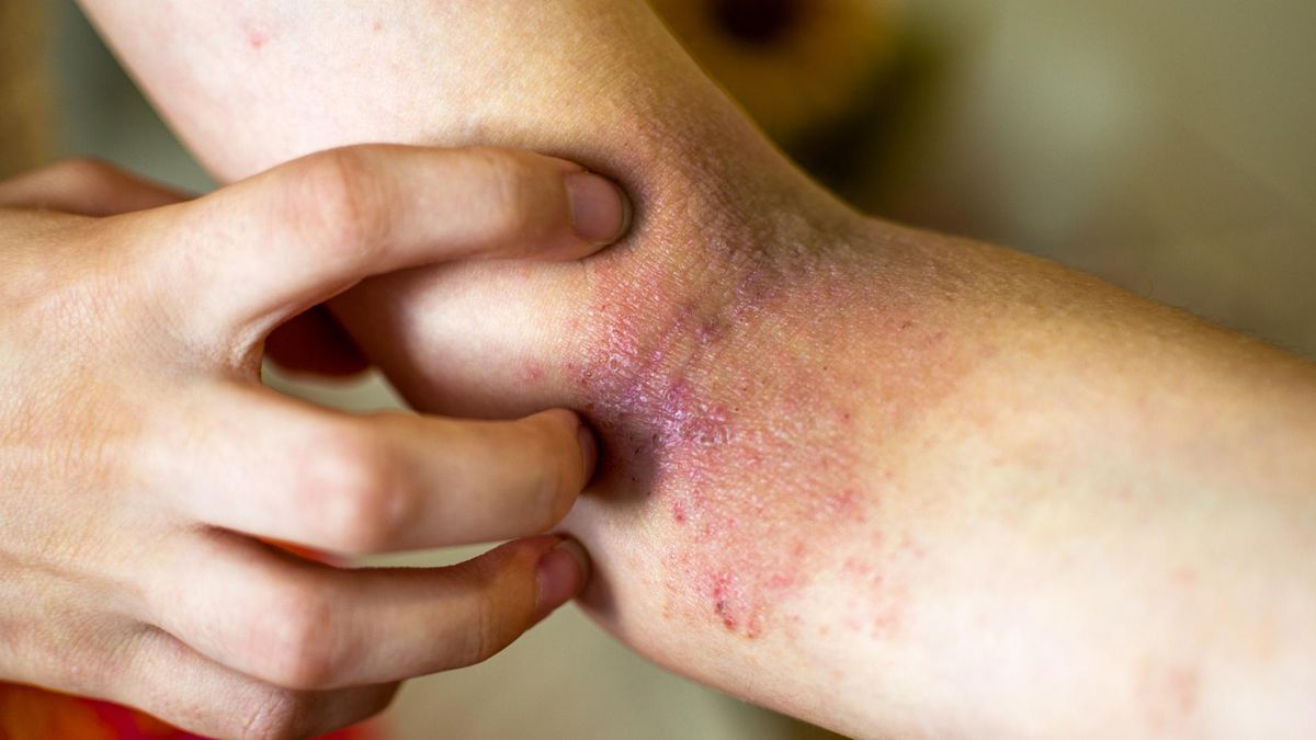 Świąd skóry i żółtaczka mogą być sygnałami alarmowymi