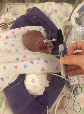 Dzieci będą wymagały rehabilitacji, ale udało im się przeżyć