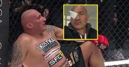Najman wylądował na SOR-ze. Pokazał poobijaną twarz