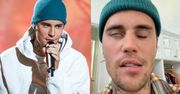 Justin Bieber dzieli się nowymi informacjami na temat stanu zdrowia! "Wiem, że ta burza minie"