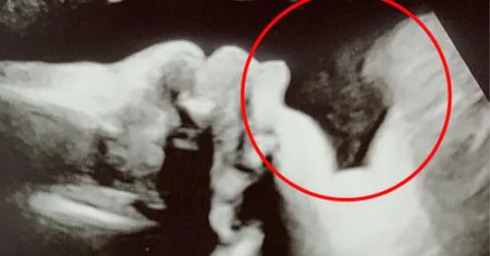 Dwukrotnie poroniła. Twierdzi, że na zdjęciu USG kolejnego dziecka pilnuje anioł