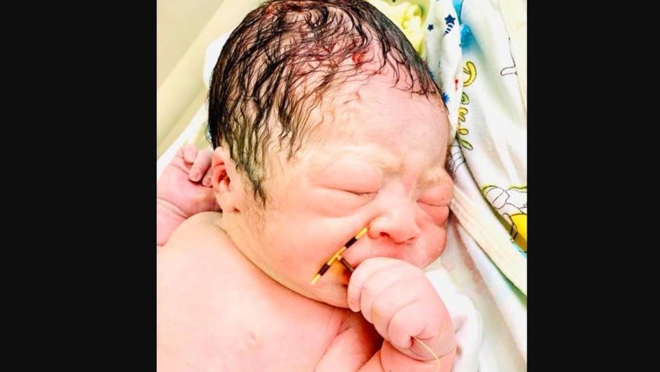 Niesamowity widok na sali porodowej. Zdjęcie podbija internet