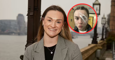 23-latka doznała udaru na wakacjach. Mówi, jaki był jedyny objaw
