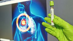 Koronawirus. U bezobjawowych COVID-19 też powoduje uszkodzenia w płucach