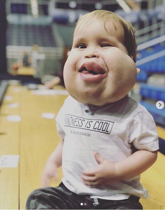 Chłopiec jest ciekawy świata (Intsagram/gavinsmedicaladventure)