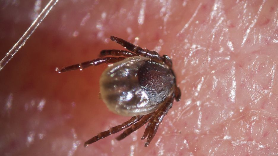 Koronawirus i borelioza. Naukowcy wskazują na podobne objawy