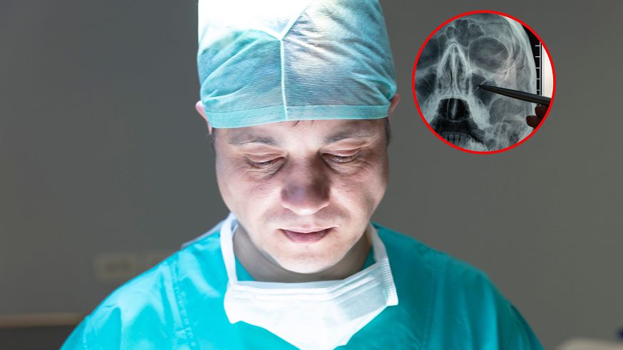 Przez 30 lat lekarze nie odkryli, że ma kamienie nosowe