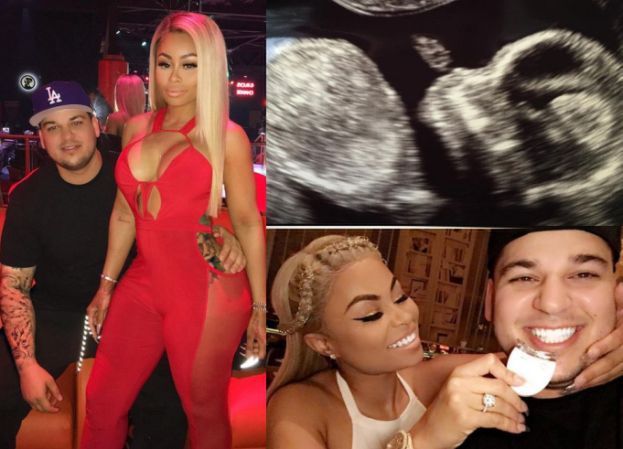 Blac Chyna pokazała USG "małego Roba Kardashiana III" (FOTO)