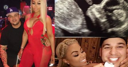 Blac Chyna pokazała USG "małego Roba Kardashiana III" (FOTO)