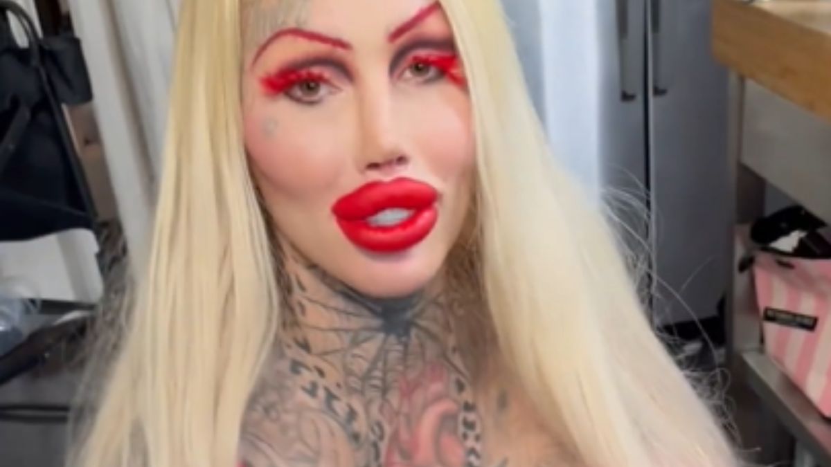 Modelka zdecydowała się usunąć implanty