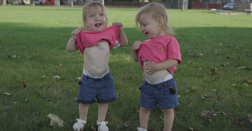 Sarabeth i Amelia rozwijają się prawidłowo