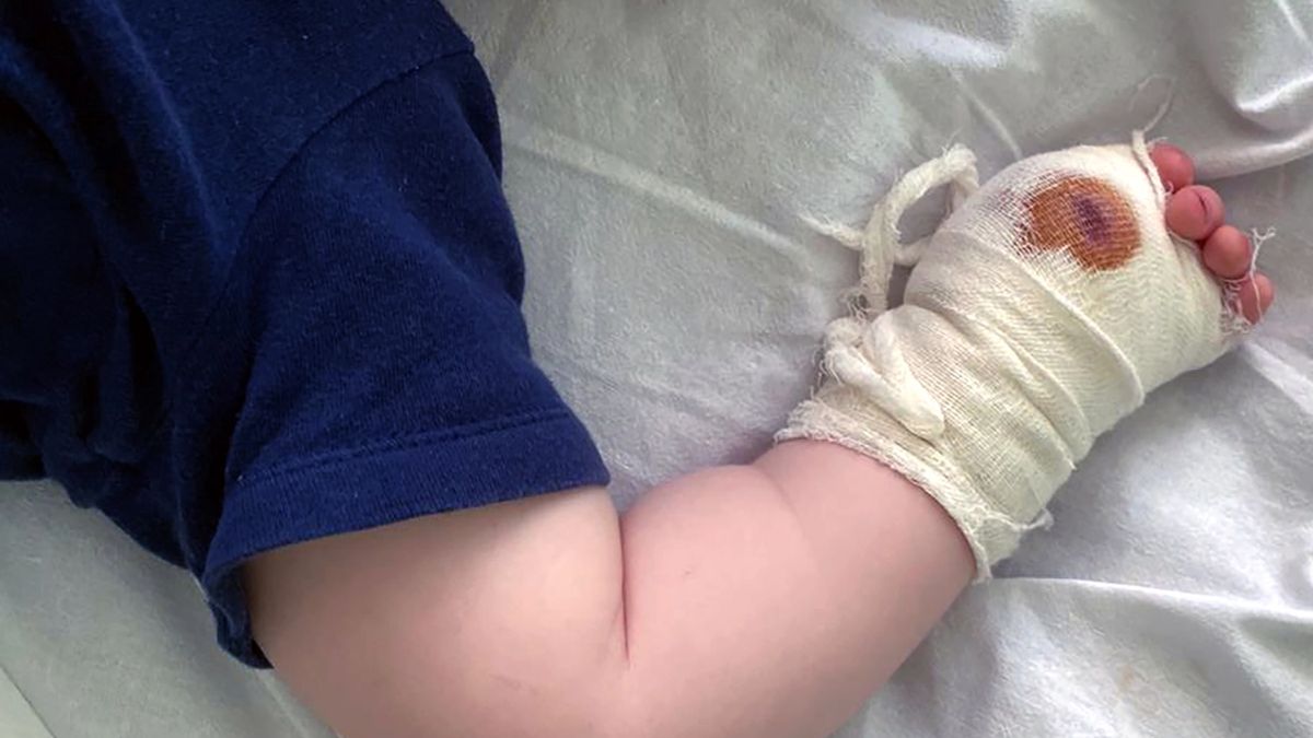 Tragedia w zoo. Chłopiec stracił kciuk