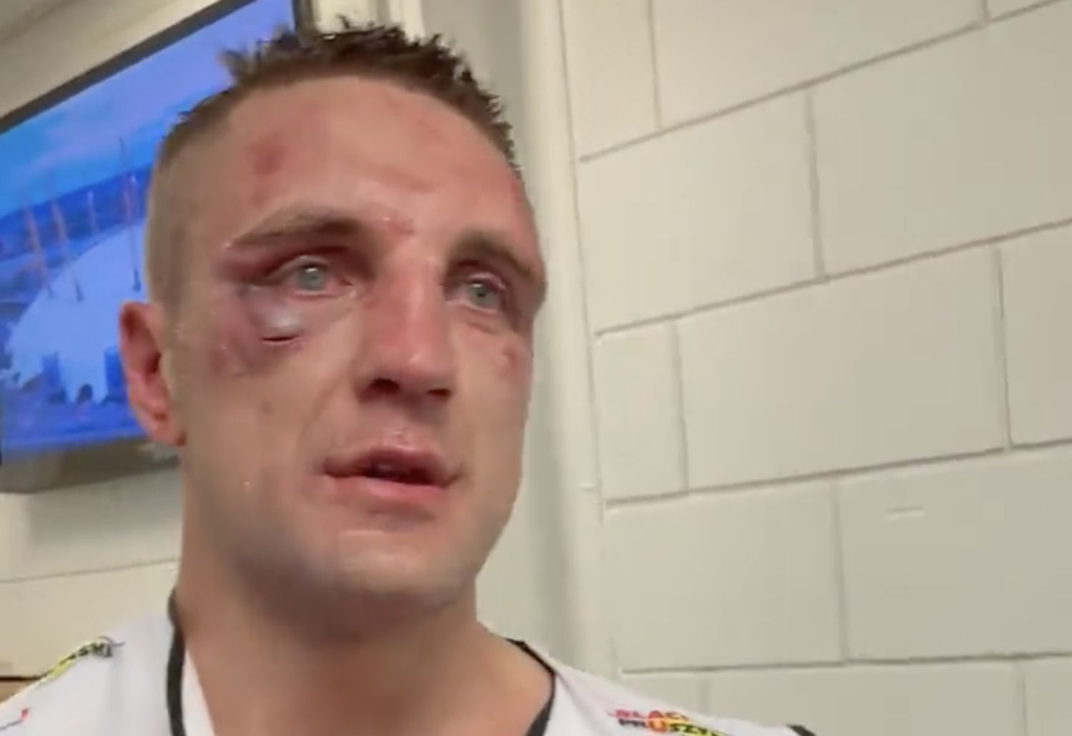 Polski bokser pokazał twarz po walce. To nie jest przyjemny widok