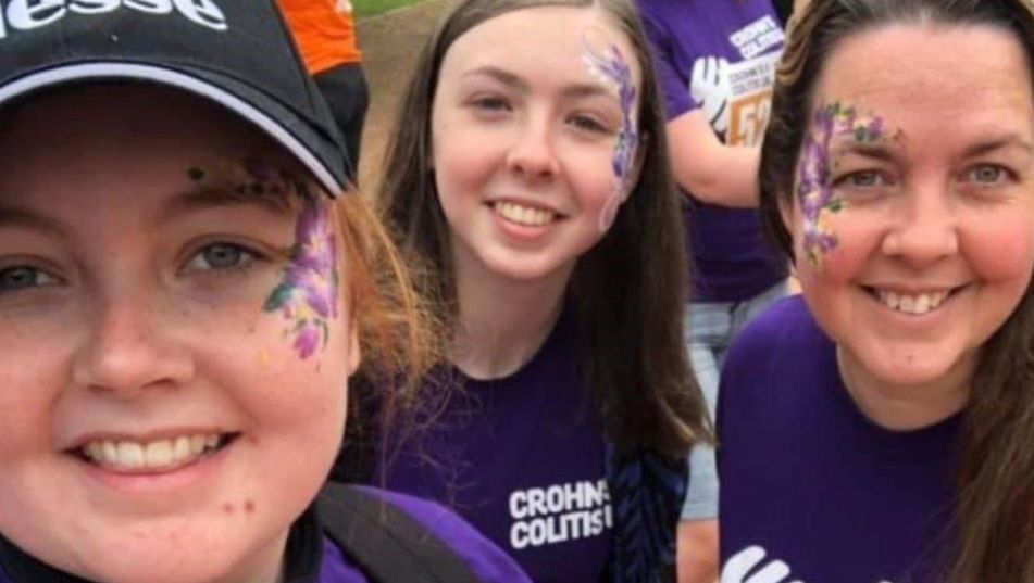 Dwie siostry zachorowały na chorobę Leśniowskiego-Crohna