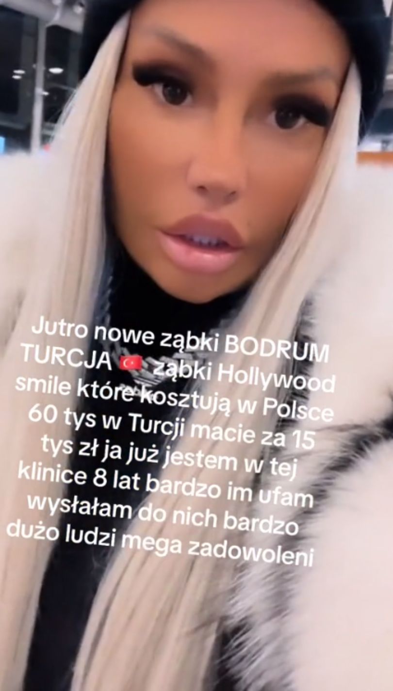 Laluna Unique poleciała do Turcji, by zrobić sobie nowe zęby