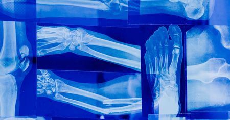 Ile człowiek ma...? 14 zagadek anatomicznych