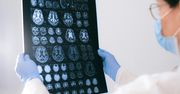 Poznań: Bezpłatnie zbadasz swój mózg. Rusza akcja Skonsultuj z Farmaceutą. Sprawdzisz, czy nie masz Alzheimera czy Parkinsona