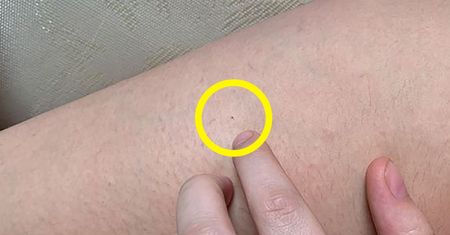 Kobiety wychodzą zabawić się do klubu. Budzą się ze śladem po igle