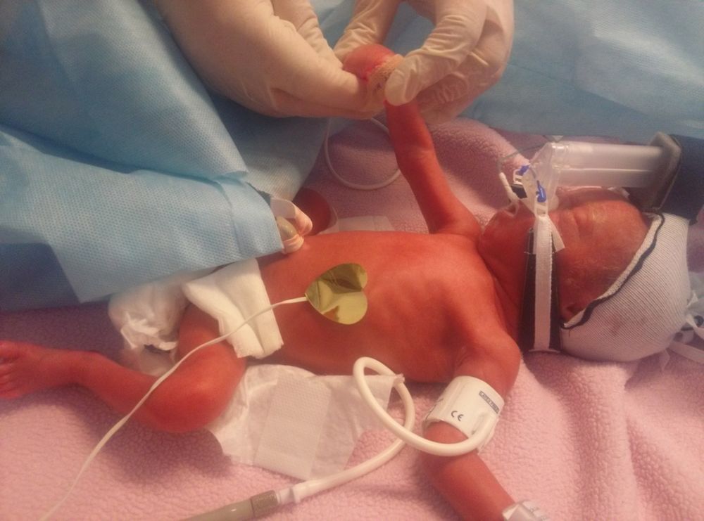 Amelka od pierwszych chwil walczy o życie