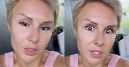 Blanka Lipińska skarży się na blizny po blefaroplastyce. Musiała ją poprawiać: "Mam uszkodzone dźwigacze powieki górnej"