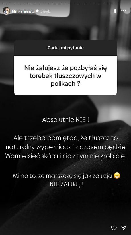 Blanka Lipińska o poprawkach w wyglądzie
