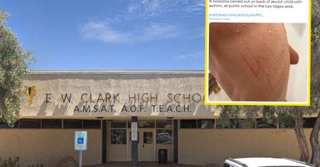 USA. 17-letni Żyd z autyzmem wrócił do domu ze swastyką wyrytą na plecach