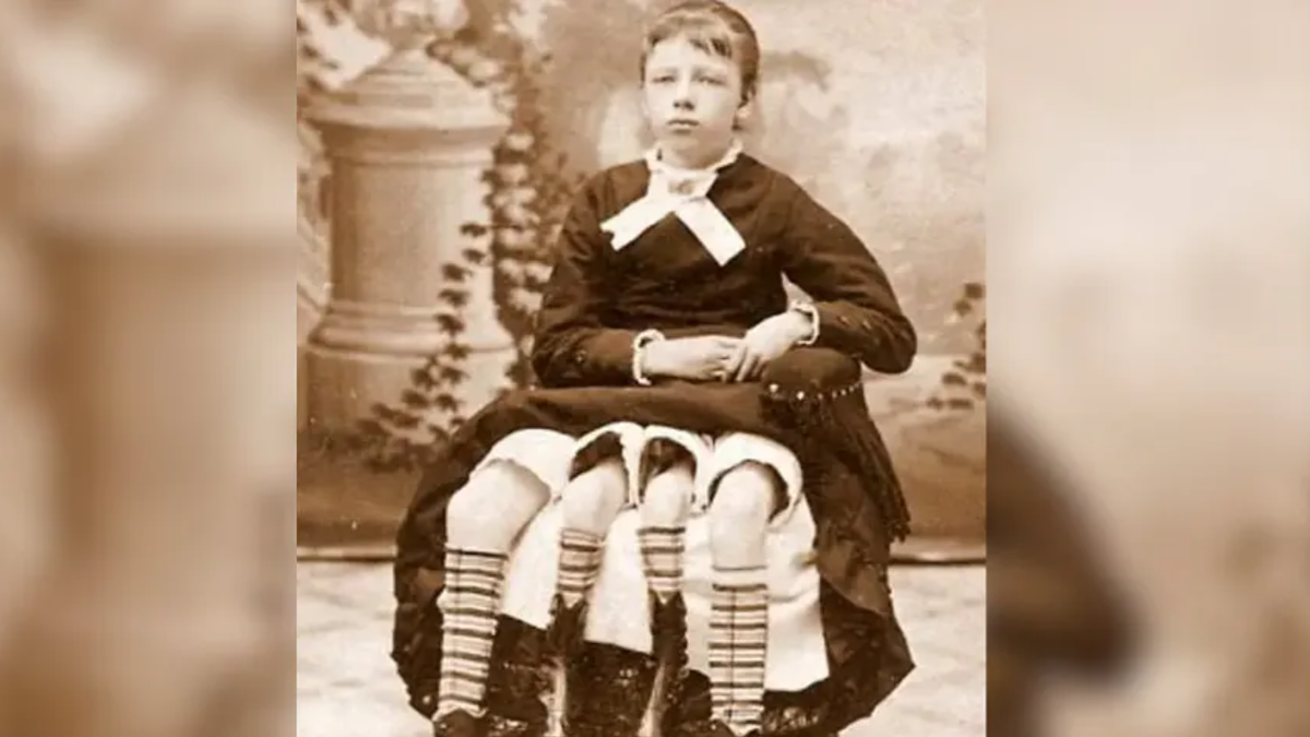 Josephine miała cztery nogi