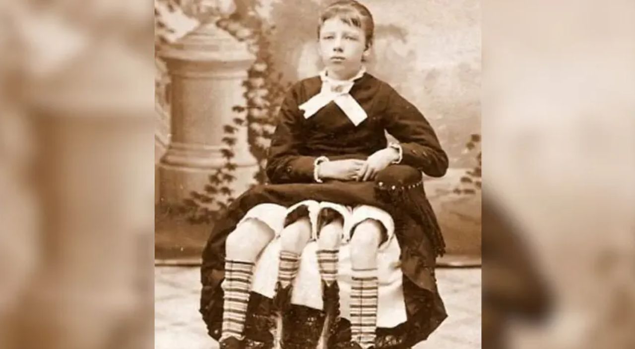 Urodziła się z czterema nogami. Dopiero ciąża ujawniła przyczynę