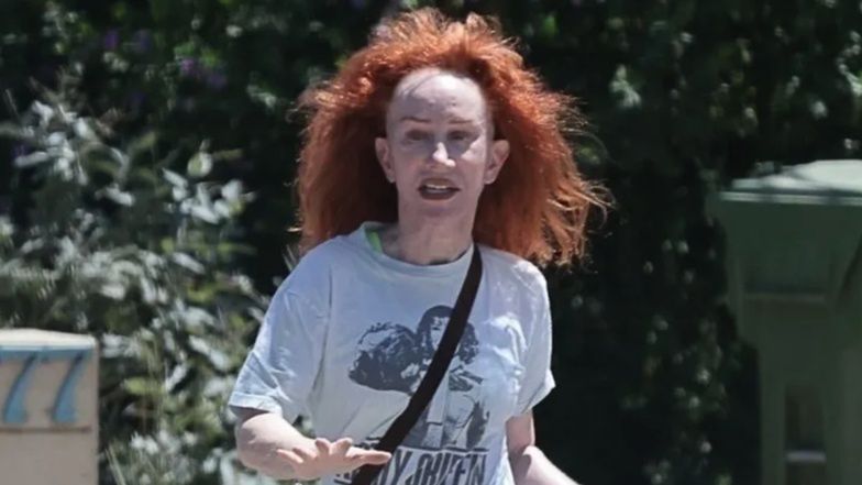 Kathy Griffin zrobiła sobie trzeci lifting