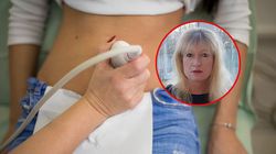 Główny objaw raka trzustki. "U 25 proc. pojawia się 6 mies. przed rozpoznaniem"