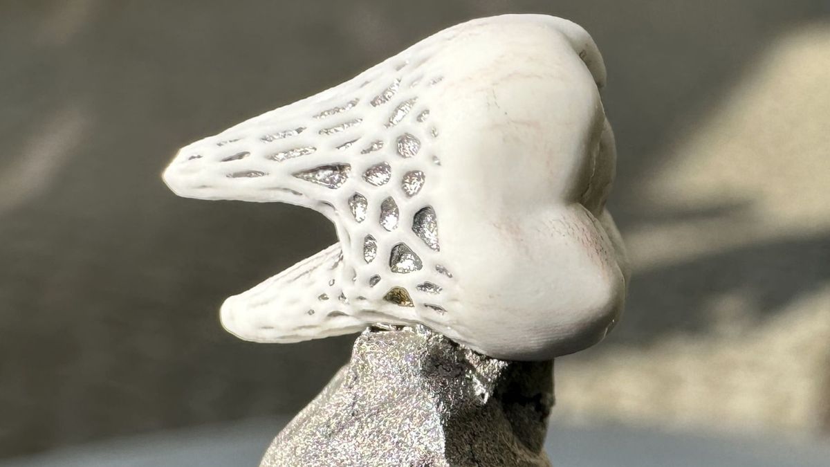 Implanty zębów wykonane w technologii 3D