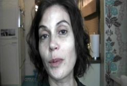 Gotowa na wszystko Teri Hatcher oszpecona