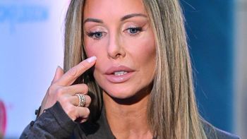 Małgorzata Rozenek gorzko o liftingu twarzy u młodych gwiazd. "Mają prawo sobie wymyślać"