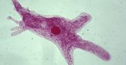 "Zjada mózg". Ten mikroorganizm jest niezwykle niebezpieczny