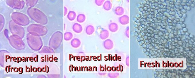 Cząsteczki krwi widziane przez DIPLE
