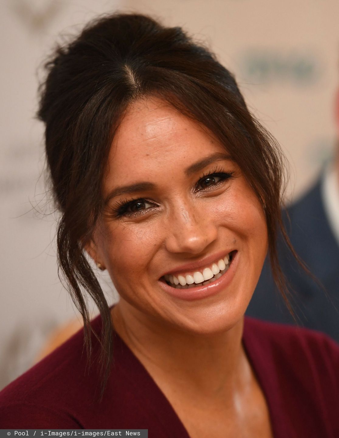 Meghan Markle poprawiła uzębienie