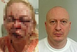 On ją skatował. Tym zdjęciem ofiara ostrzega przed przemocą domową