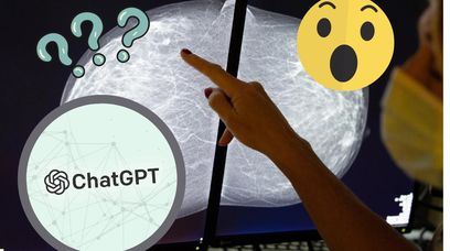 ChatGPT uczy o raku piersi. Czy AI zastąpi lekarzy?