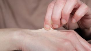 Uszczypnij się. Prosty test, dzięki któremu w kilka sekund możesz stwierdzić, czy jesteś odwodniony