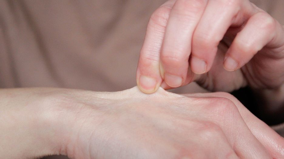 Skin test
