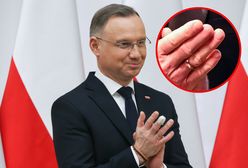 Kontuzja Dudy. Były prezydent ujawnia tajemnicę uciętego palca