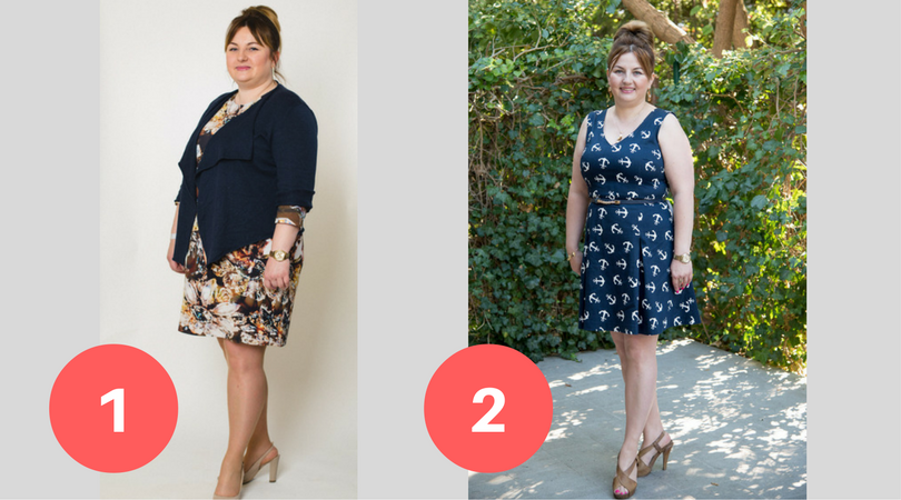 Pani Ewa przed i po operacji bariatrycznej / Żagiel Med