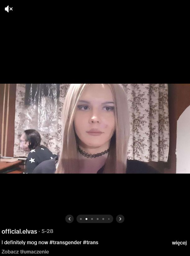 Elva przed wstrzyknięciem silikonu 
