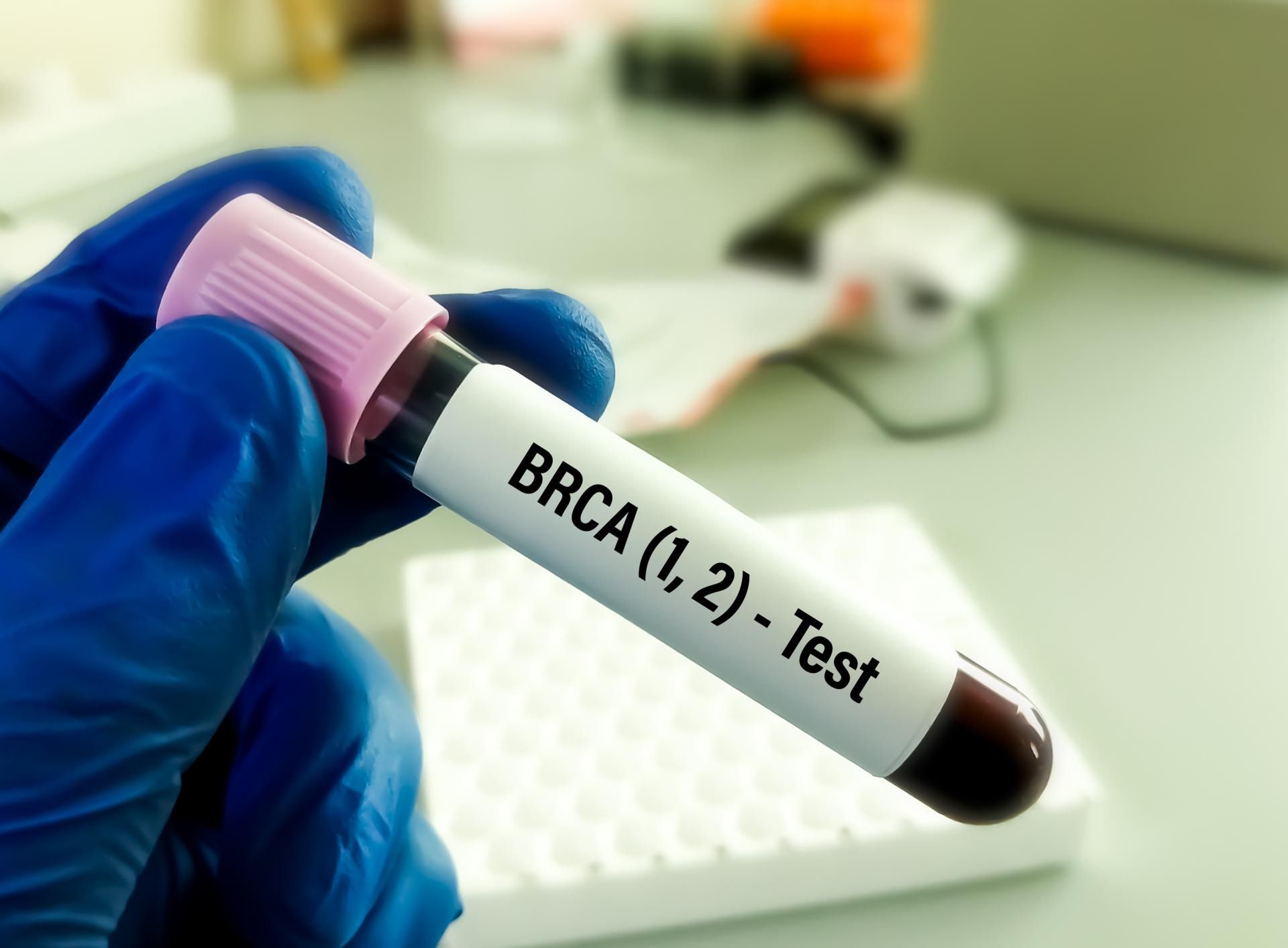 Mutacje w genach BRCA1 i BRCA2 zwiększają ryzyko nowotworów